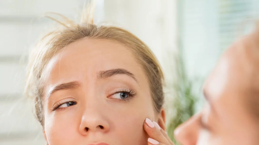 Πρησμένα μάτια, μαύροι κύκλοι, φουσκωμένο πρόσωπο: Πώς αντιμετωπίζονται τα προβλήματα ομορφιάς του hangover;