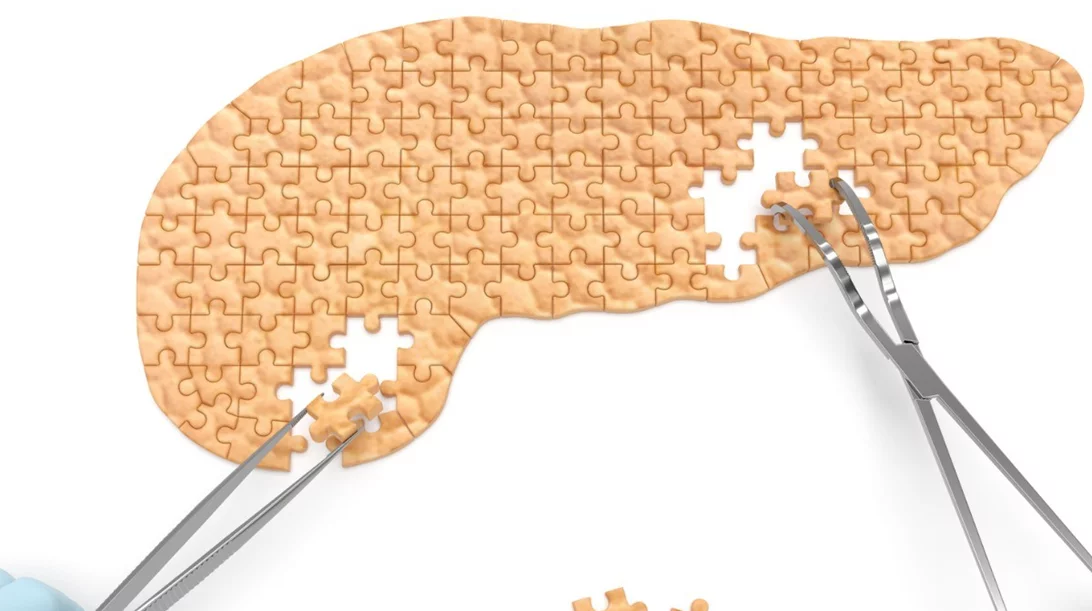 Καρκίνος στο πάγκρεας: Από την παθογένεση στη διάγνωση και τη θεραπεία