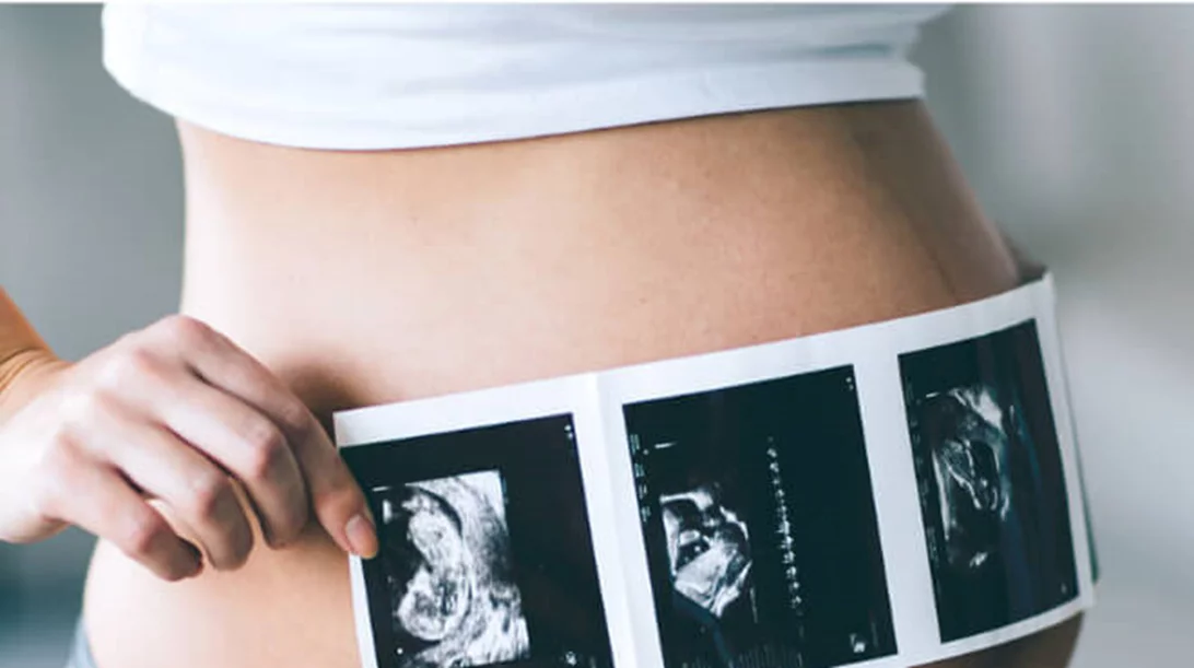 Μη επεμβατικό προγεννητικό τεστ: Πού διαφοροποιείται και γιατί να το επιλέξεις;
