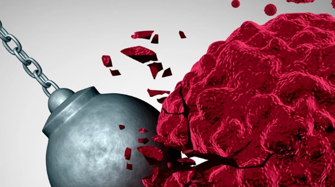 Τι έχει αλλάξει στην ανοσοθεραπεία για τον καρκίνο του μαστού;