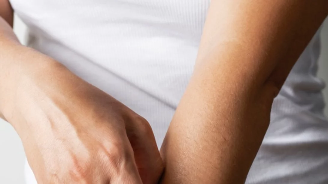 Πώς θα προστατευτείς από τον ιό του Δυτικού Νείλου