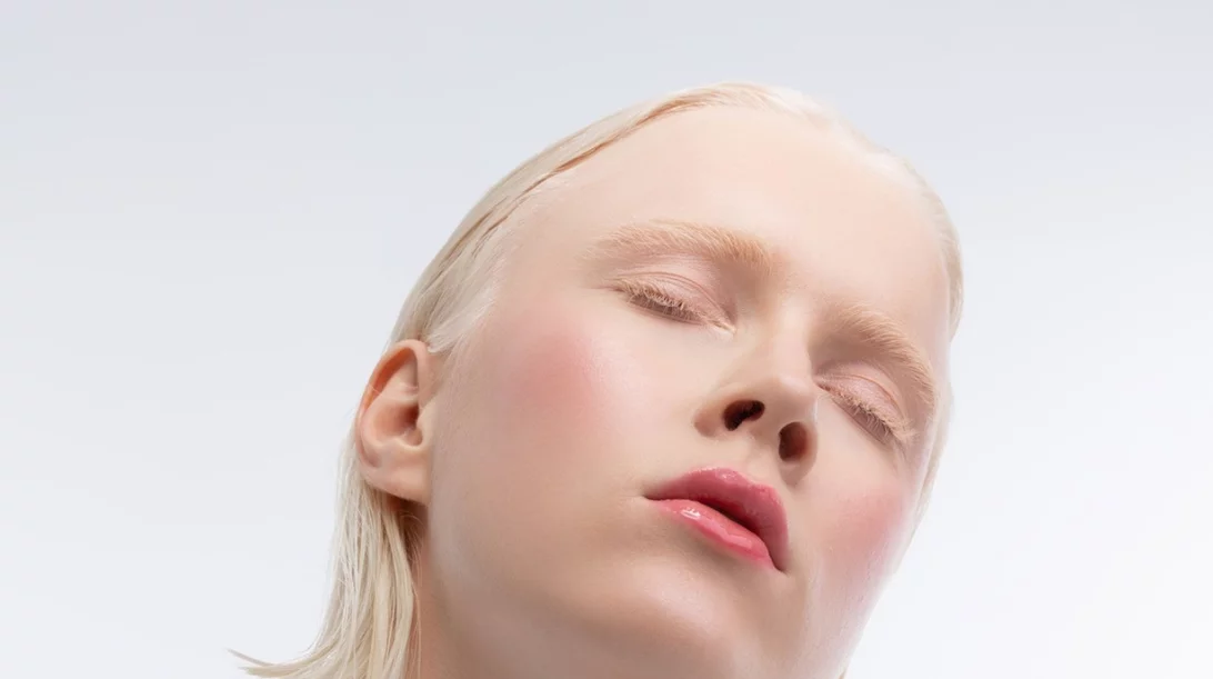 Τι είναι ο αλφισμός από τον οποίο πάσχει το μοντέλο Ανδριανή Ζαχάρη