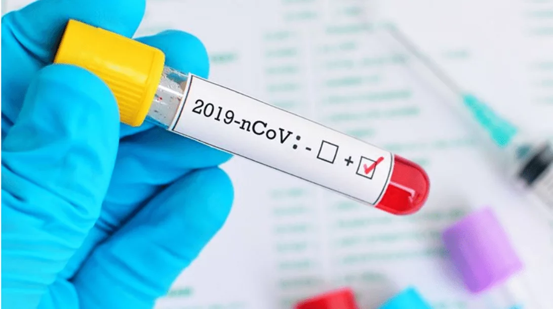 Κορονοϊός: Πέμπτος νεκρός στην Ελλάδα - Στα 387 έφτασαν τα κρούσματα