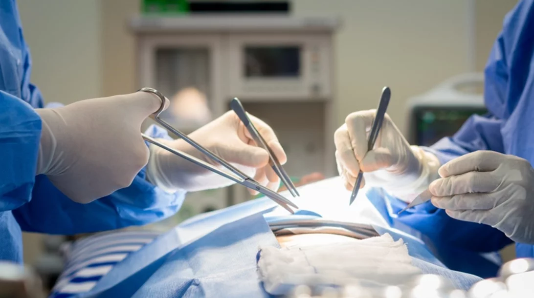 Το Ιατρικό Κέντρο Αθηνών πρωτοπορεί: Επιτυχής αντιμετώπιση υποτροπιάζοντος καρκίνου του ορθού με τη μέθοδο της κοίλιο-ιερεκτομής