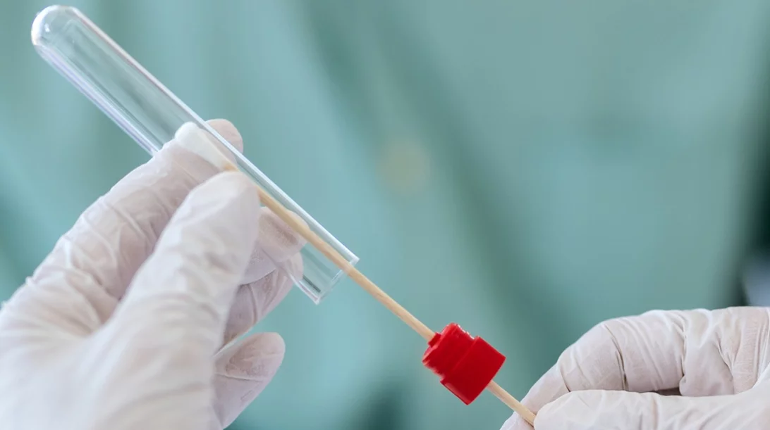 Μοριακό τεστ για κορονοϊό: Πιο πιθανό να βγει θετικό αν το κάνεις μετά το μεσημέρι!