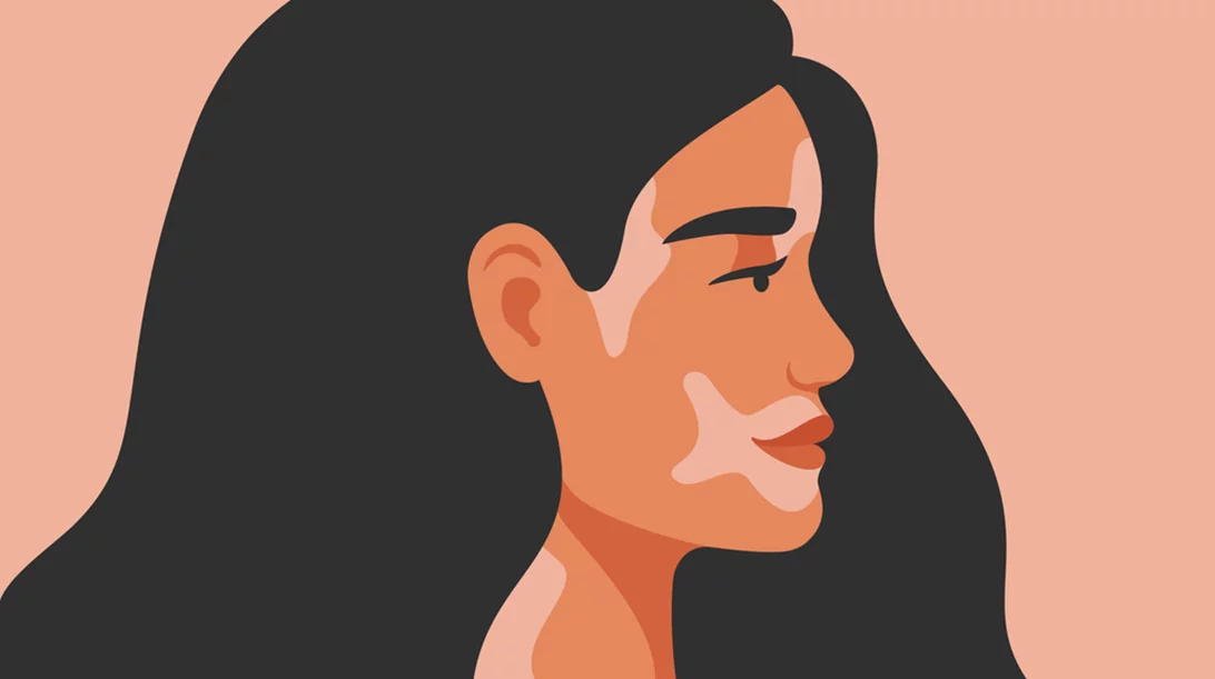 "Δεν είμαι το αυτοάνοσό μου"