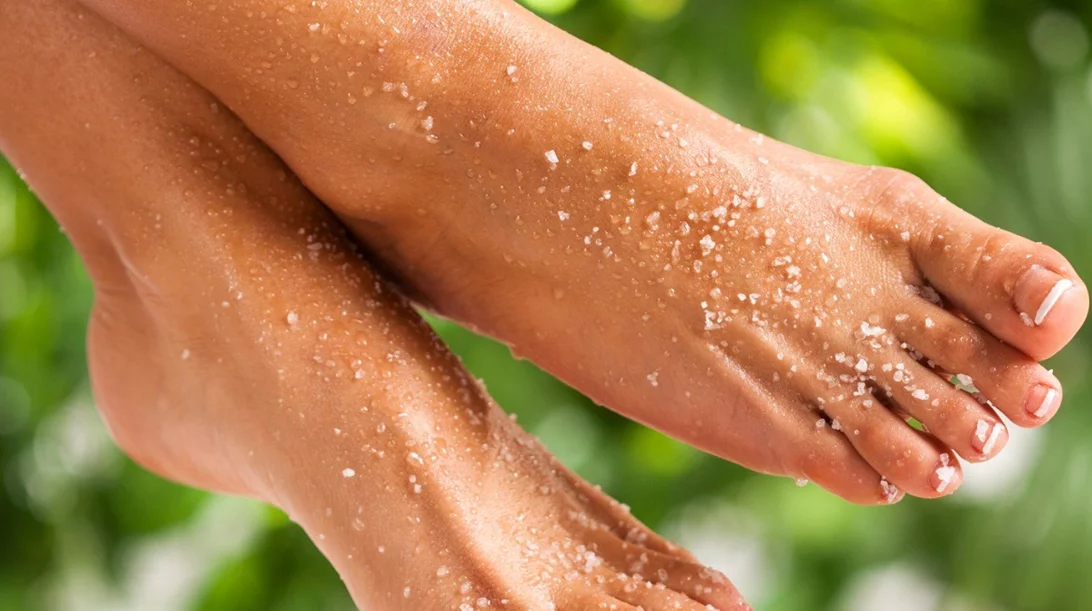 Σκασμένες φτέρνες: Έτσι θα αποκτήσεις πραγματικά λεία και απαλά πέλματα