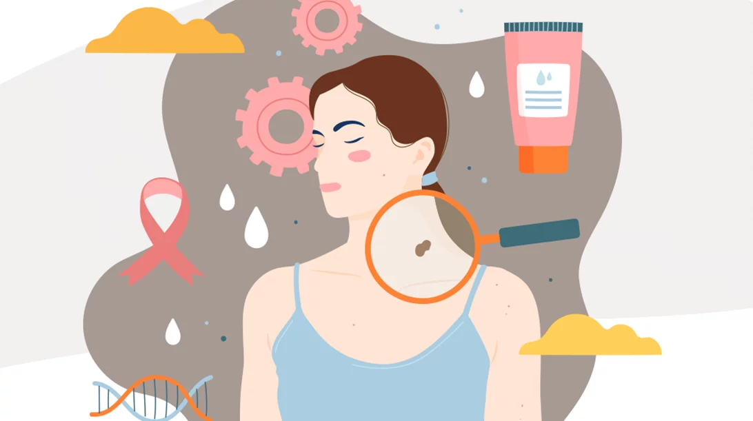 Το ΙΑΣΩ Γενική Κλινική ανακοίνωσε τη δωρεάν κλινική εκτίμηση σπίλων για την πρόληψη του καρκίνου του δέρματος