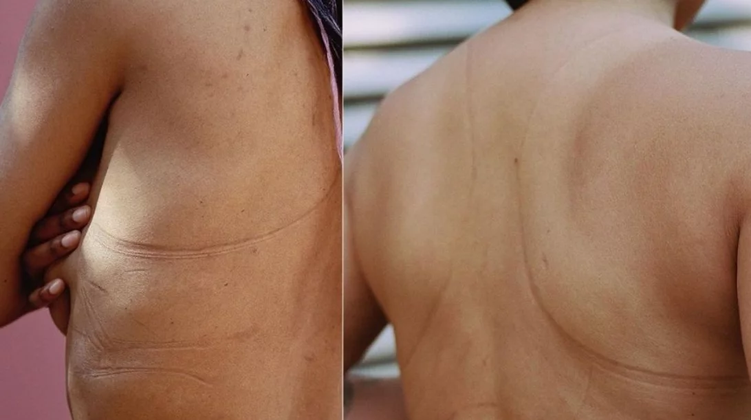 Η νέα καμπάνια της Adidas είναι μια ωδή στο γυναικείο στήθος