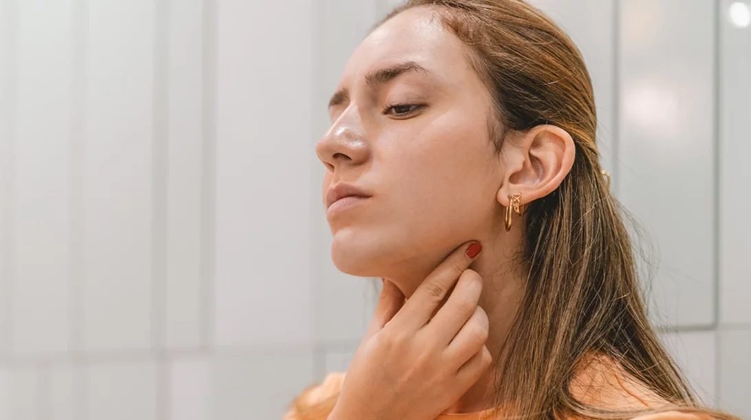 Διπλοσάγονο: 5 σπιτικές θεραπείες που κάνουν δουλειά!