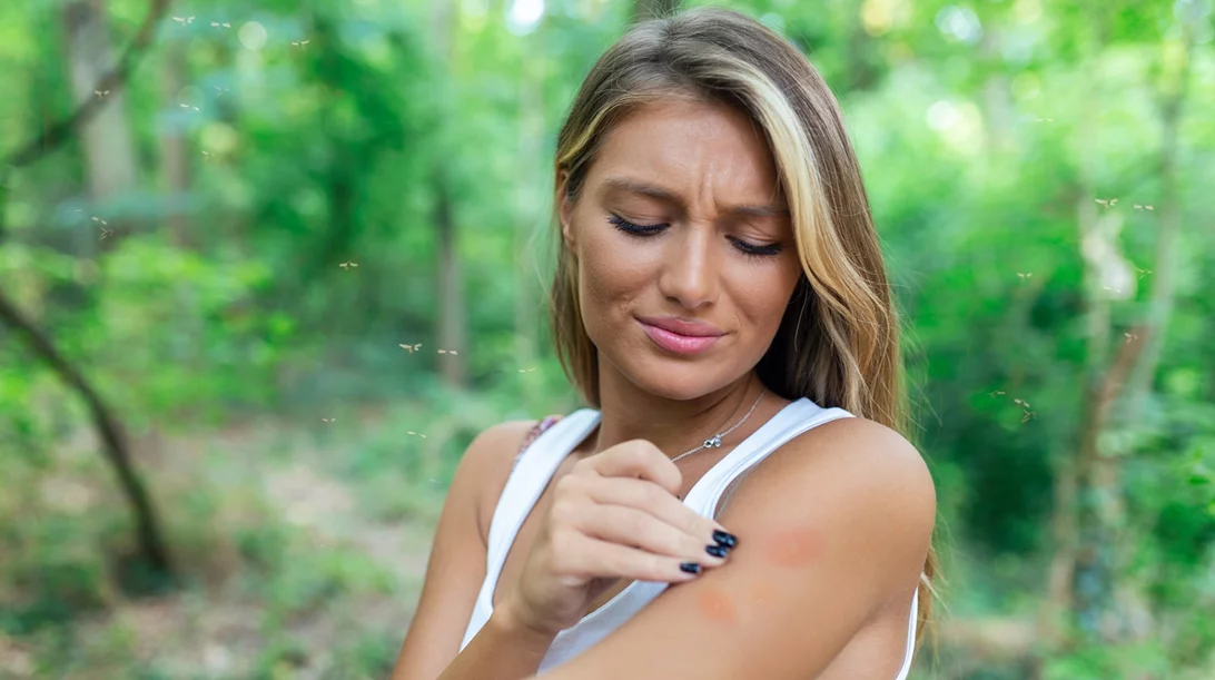 Είσαι "γλυκοαίματη"; Δοκίμασε αυτό για να απωθήσεις τα κουνούπια