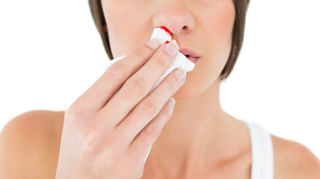 Τι να κάνεις αν ανοίξει η μύτη σου;