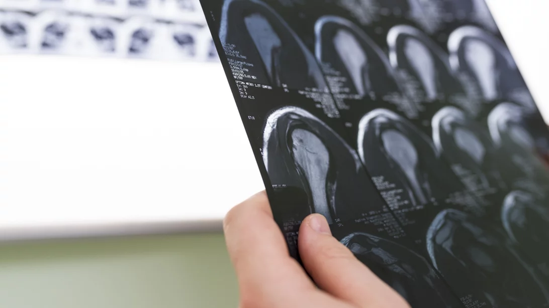 Η σημασία της εξειδίκευσης στην Ορθοπαιδική και το όραμα της Synovus στην Αθήνα