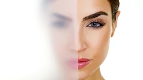 Πώς να αποκτήσεις δέρμα λείο σαν γυαλί: Οδηγός για Glass Skin στο σπίτι