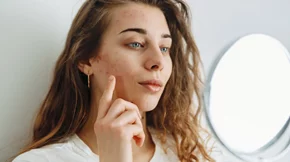 Άμεση δράση: 7 προϊόντα που "εξαφανίζουν" τα σπυράκια, τα στίγματα και τα σημάδια