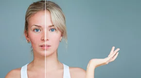 Τι είναι η ροδόχρους νόσος από την οποία πάσχει η Μαίρη Συνατσάκη;