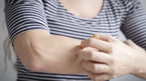 6 τρόφιμα που καταναλώνεις και αυξάνουν τις πιθανότητες να σε τσιμπήσουν τα κουνούπια