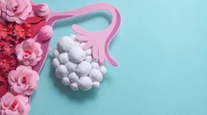 Έχεις πολυκυστικές ωοθήκες; Κάνε αυτό που προτείνει ελληνική έρευνα