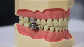 "Πρωτοποριακή" συσκευή κατά της παχυσαρκίας προκαλεί παγκόσμιο σοκ