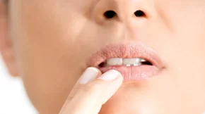 Πώς θα εξαφανίσεις τον επιχείλιο έρπη