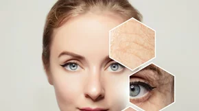 Διεσταλμένοι πόροι; Όλα όσα πρέπει να γνωρίζεις για να αντιμετωπίσεις το πρόβλημα