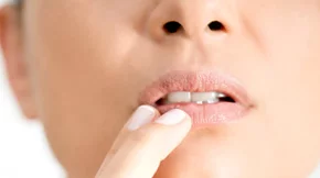 Επιχείλιος Έρπης: Οι εναλλακτικές θεραπείες που αξίζει να ξέρεις