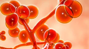 Τι είναι ο candida auris που φοβάται η ιατρική κοινότητα και τι συμβαίνει στην Ελλάδα