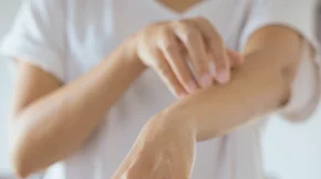 Θεραπεία για ψωρίαση: Οι σημαντικές εξελίξεις στην Ελλάδα