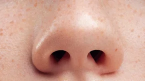 Τι είναι διορθωτική ρινοπλαστική και άλλες συχνές απορίες για την επέμβαση βρίσκουν απάντηση