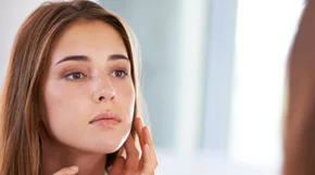 Γιατί έχεις ακόμα ακμή και τι πρέπει να προσέξεις για να τη μειώσεις;