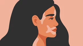 "Δεν είμαι το αυτοάνοσό μου"