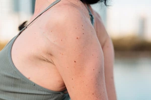 Μαγειρεύεις πολύ; Μήπως κινδυνεύεις από σύνδρομο του καρπιαίου σωλήνα; - εικόνα 1