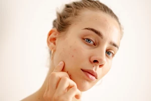 Bone Broth: Το φυσικό ελιξίριο νεότητας για το δέρμα σου - εικόνα 1