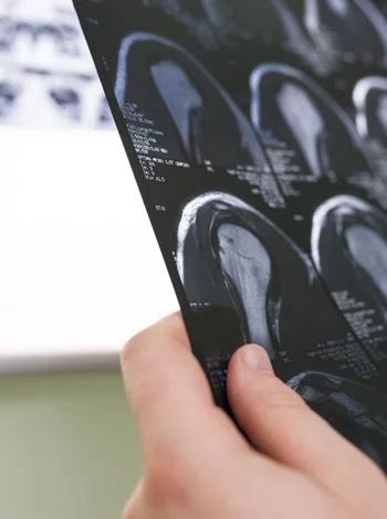 Η σημασία της εξειδίκευσης στην Ορθοπαιδική και το όραμα της Synovus στην Αθήνα