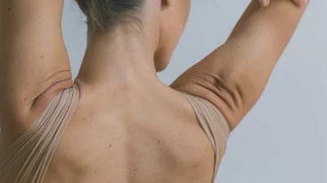 Ραγάδες στους ώμους: Τι τις προκαλεί και πώς να τις αντιμετωπίσεις;