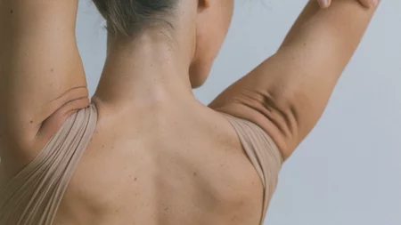 Ραγάδες στους ώμους: Τι τις προκαλεί και πώς να τις αντιμετωπίσεις;