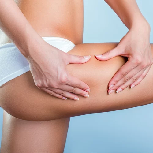 Πώς θα απαλλαγείς αποτελεσματικά από την κυτταρίτιδα και το τοπικό πάχος