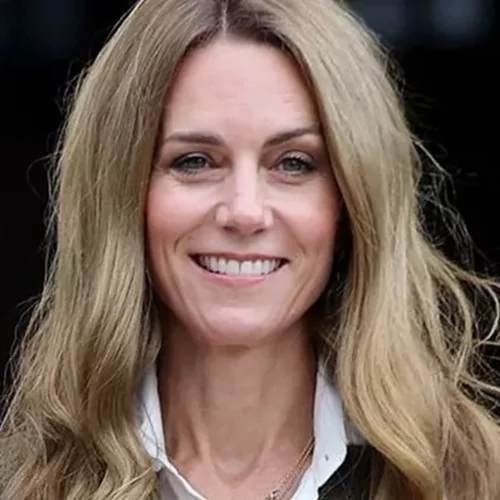 Όταν η περούκα της Kate έδειξε τη γυμνή αλήθεια μιας κοινωνίας