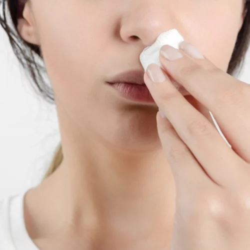 Γιατί ανοίγει η μύτη μας; Τα πιο συχνά αίτια της ρινορραγίας