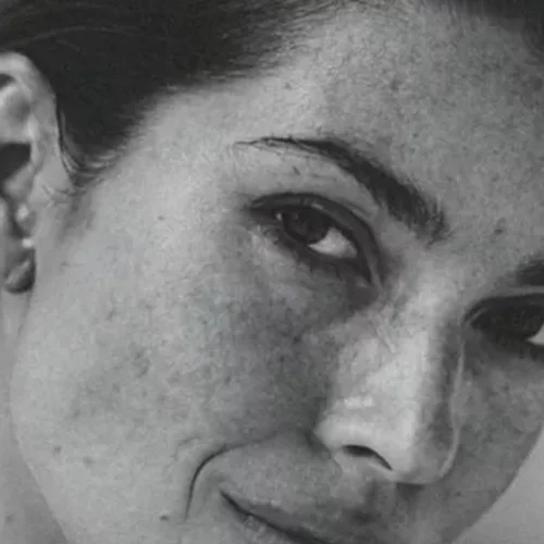 Oι ουλές στο σώμα της Βάσιας Κωσταρά δίνουν ένα μήνυμα ελπίδας