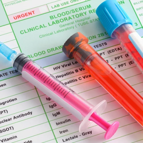 Νέα έρευνα: Η ομάδα αίματος δεν φαίνεται να επηρεάζει την πιθανότητα λοίμωξης ή τη σοβαρότητα της Covid-19