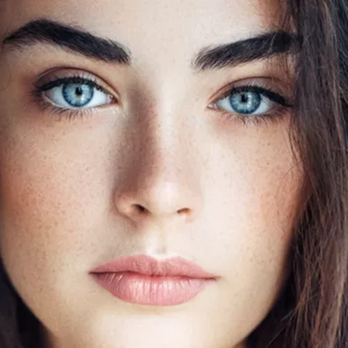 Σπυράκια, θαμπάδα, ξηρότητα: Ξέρουμε γιατί μπορεί να εμφανίζεις (αδικαιολόγητα) ένα από τα παραπάνω συμπτώματα