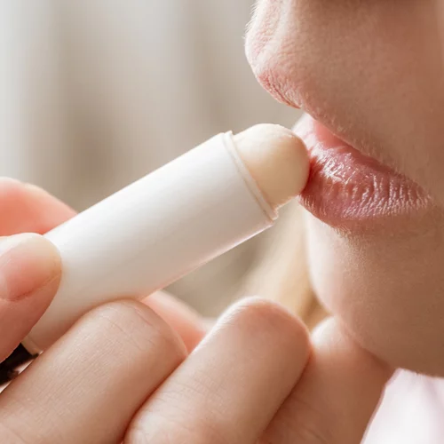 Το lip balm βοηθάει πραγματικά τα σκασμένα χείλη ή τα κάνει χειρότερα; Οι ειδικοί απαντούν