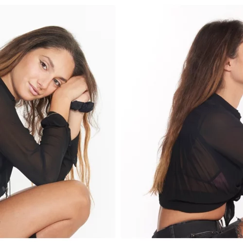 Αθηνά Κλήμη | Η ζωή μου με τη σταγονοειδή ψωρίαση