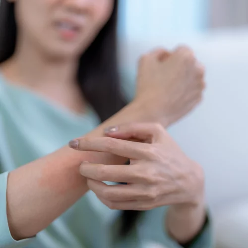 Πώς θα φτιάξεις φυσικό αντικουνουπικό - Eύκολο, αποτελεσματικό και ασφαλές