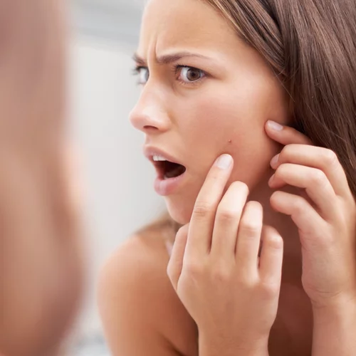 Πώς οι τοξικοί άνθρωποι σου προκαλούν σπυράκια; Τι να κάνεις