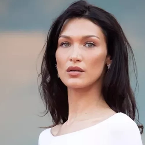 Το πανέξυπνο (και ανέξοδο) hack των celebrities που "σβήνει" τις ρυτίδες