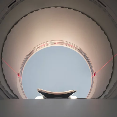 PET/CT: Η εξέταση που ανιχνεύει με ακρίβεια τον καρκίνο