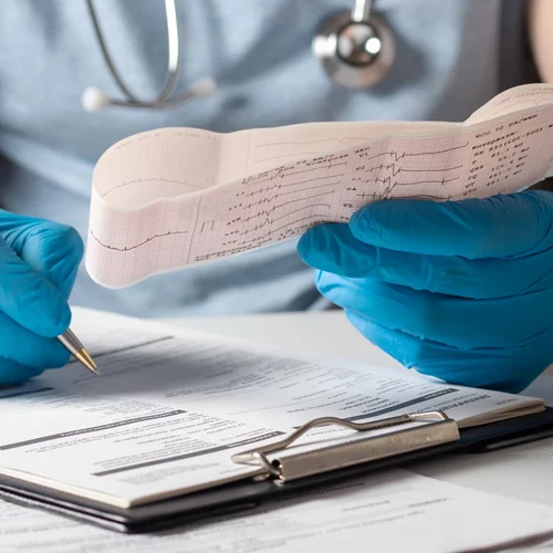 Stress echo: Σε τι διαφέρει από το τεστ κοπώσεως;