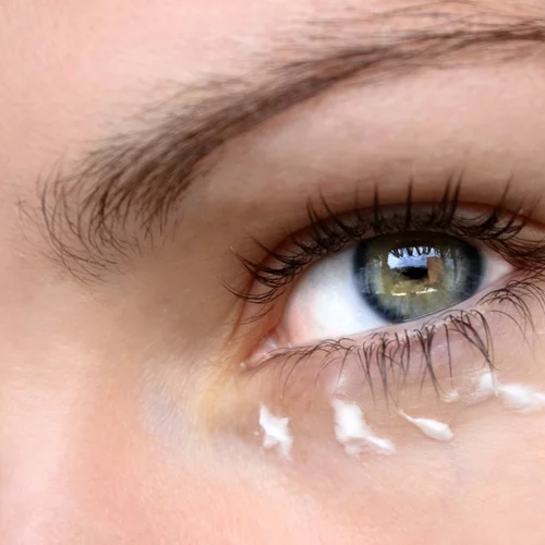 Μαύροι κύκλοι, σακούλες, πρήξιμο στα μάτια: Αυτή την κρέμα ματιών χρειάζεσαι τώρα